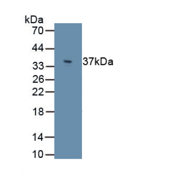 Perilipin 3 (PLIN3) Human Polyclonal Antibody
