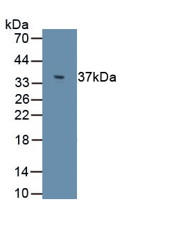 Perilipin 3 (PLIN3) Human Polyclonal Antibody