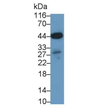 Perilipin 3 (PLIN3) Human Polyclonal Antibody