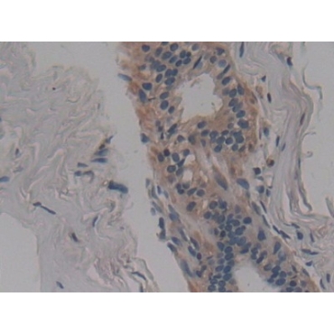 Neutral Sphingomyelinase Activation Associated Factor (NSMAF) Human Polyclonal Antibody