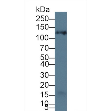 Protocadherin 15 (PCDH15) Mouse Polyclonal Antibody