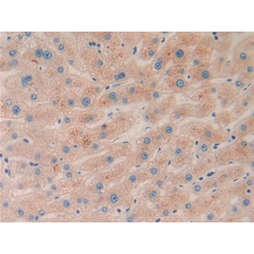 Ephrin A5 (EFNA5) Human Polyclonal Antibody