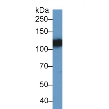 Ephrin Type A Receptor 4 (EPHA4) Human Polyclonal Antibody