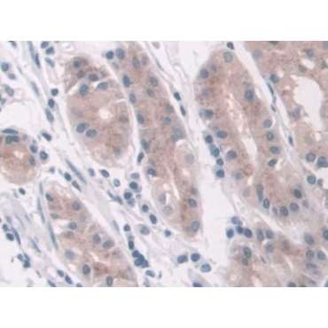 Lactate Dehydrogenase D (LDHD) Human Polyclonal Antibody