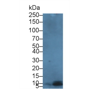 Defensin Beta 103A (DEFb103A) Human Polyclonal Antibody