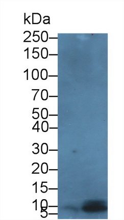Defensin Beta 103A (DEFb103A) Human Polyclonal Antibody