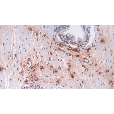 Defensin Alpha 3, Neutrophil Specific (DEFa3) Human Polyclonal Antibody