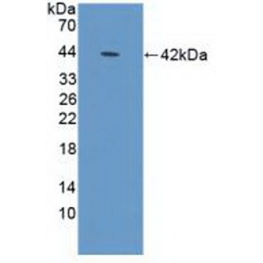 Defensin Alpha 1B (DEFa1B) Human Polyclonal Antibody