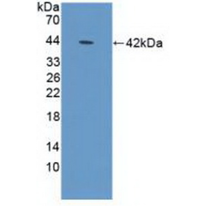 Defensin Alpha 1B (DEFa1B) Human Polyclonal Antibody