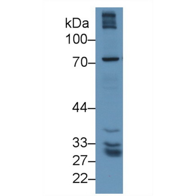 Gamma-Glutamyltransferase 5 (gGT5) Human Polyclonal Antibody