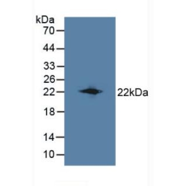 Lipocalin 8 (LCN8) Mouse Polyclonal Antibody