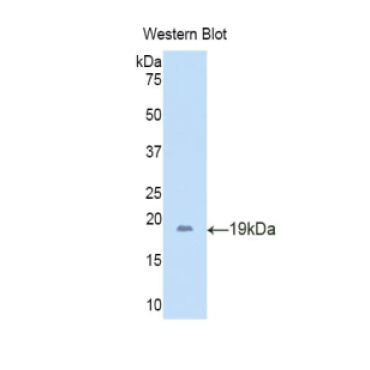 Lipocalin 6 (LCN6) Human Polyclonal Antibody