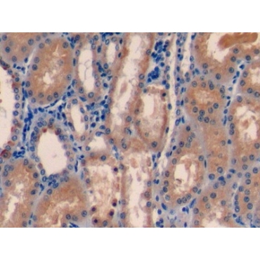 Farnesyl Diphosphate Synthase (FDPS) Human Polyclonal Antibody
