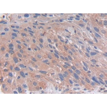 Proprotein Convertase Subtilisin/Kexin Type 5 (PCSK5) Human Polyclonal Antibody