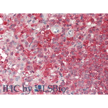 Proprotein Convertase Subtilisin/Kexin Type 9 (PCSK9) Human Polyclonal Antibody