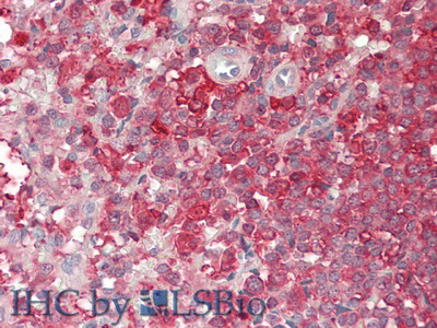 Proprotein Convertase Subtilisin/Kexin Type 9 (PCSK9) Human Polyclonal Antibody