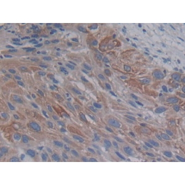 Proprotein Convertase Subtilisin/Kexin Type 9 (PCSK9) Human Polyclonal Antibody