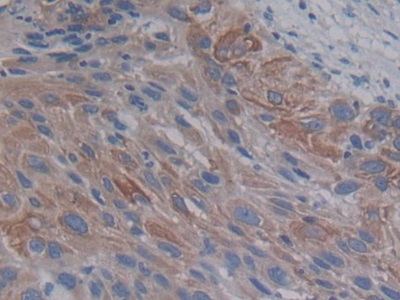 Proprotein Convertase Subtilisin/Kexin Type 9 (PCSK9) Human Polyclonal Antibody