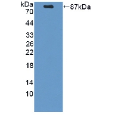 Proprotein Convertase Subtilisin/Kexin Type 9 (PCSK9) Mouse Polyclonal Antibody
