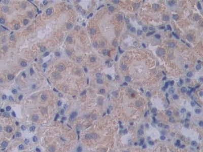 Proprotein Convertase Subtilisin/Kexin Type 1 (PCSK1) Mouse Polyclonal Antibody