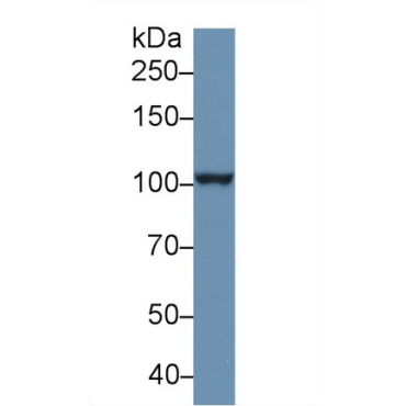 Puromycin Sensitive Aminopeptidase (PSA) Human Polyclonal Antibody