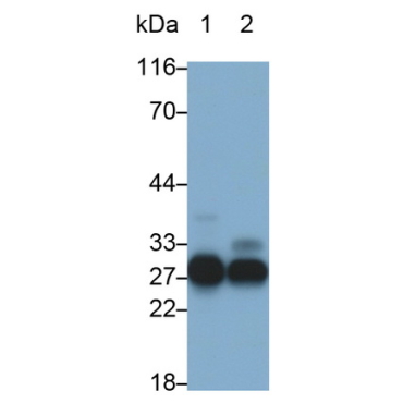Elastase 3B (ELA3B) Human Polyclonal Antibody