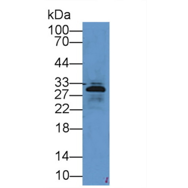 Elastase 3B (ELA3B) Mouse Polyclonal Antibody
