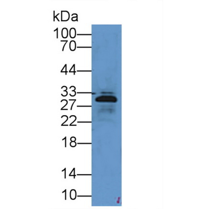 Elastase 3B (ELA3B) Mouse Polyclonal Antibody