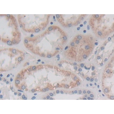 Chymotrypsinogen B1 (CTRB1) Human Polyclonal Antibody