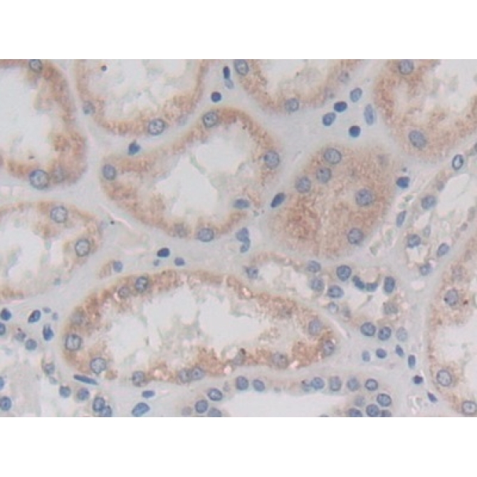 Chymotrypsinogen B1 (CTRB1) Human Polyclonal Antibody