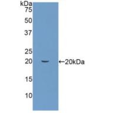 Peptidyl Prolyl Cis/Trans Isomerase NIMA Interacting Protein 1 (PIN1) Human Polyclonal Antibody