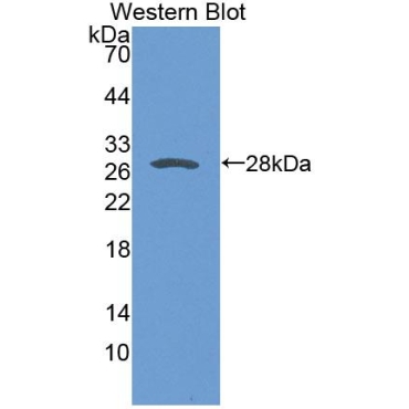 Sarcoglycan Delta (SGCd) Human Polyclonal Antibody