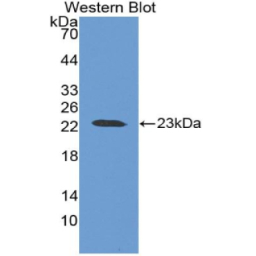 Baculoviral IAP Repeat Containing Protein 2 (BIRC2) Human Polyclonal Antibody