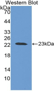 Baculoviral IAP Repeat Containing Protein 2 (BIRC2) Human Polyclonal Antibody