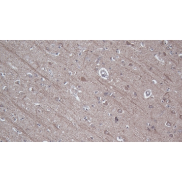Baculoviral IAP Repeat Containing Protein 2 (BIRC2) Human Polyclonal Antibody