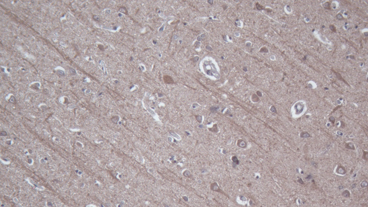 Baculoviral IAP Repeat Containing Protein 2 (BIRC2) Human Polyclonal Antibody