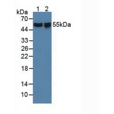 Apoptosis Inhibitor 5 (API5) Human Polyclonal Antibody