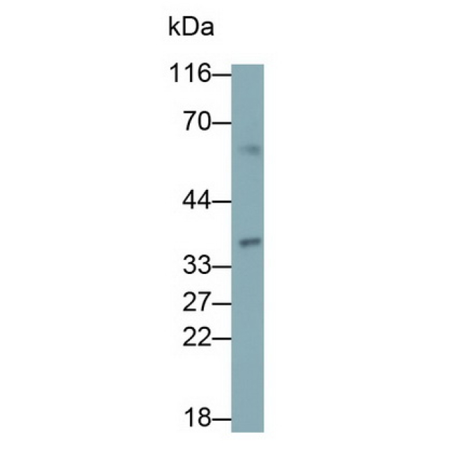 Beta-Carotene-15,15'-Monooxygenase 1 (bCMO1) Human Polyclonal Antibody