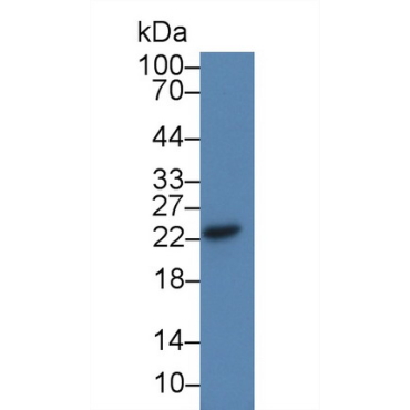 Cysteine Dioxygenase I (CDO1) Human Polyclonal Antibody