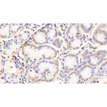 Homogentisate-1,2-Dioxygenase (HGD) Human Polyclonal Antibody