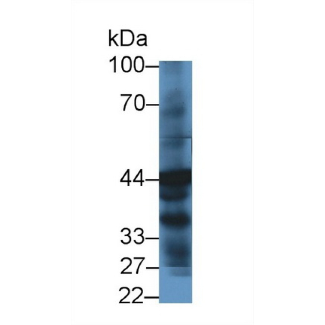 4-Hydroxyphenylpyruvate Dioxygenase (HPD) Human Polyclonal Antibody