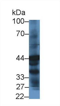 4-Hydroxyphenylpyruvate Dioxygenase (HPD) Human Polyclonal Antibody