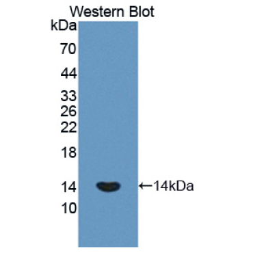 Procollagen Lysine-1,2-Oxoglutarate-5-Dioxygenase 1 (PLOD1) Human Polyclonal Antibody