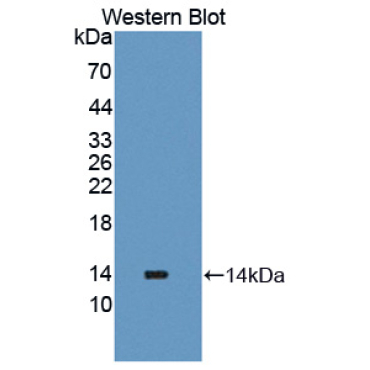 Procollagen Lysine-2-Oxoglutarate-5-Dioxygenase 2 (PLOD2) Human Polyclonal Antibody