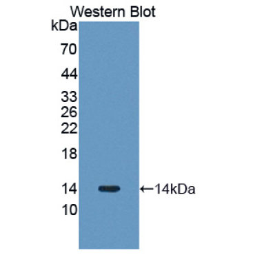 Procollagen Lysine-2-Oxoglutarate-5-Dioxygenase 3 (PLOD3) Human Polyclonal Antibody