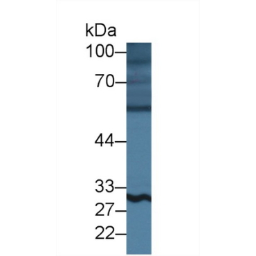 B-Lymphoid Tyrosine Kinase (BLK) Human Polyclonal Antibody