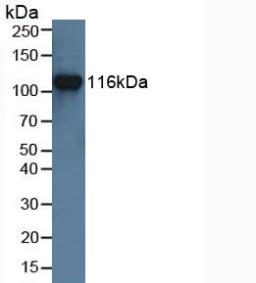 Muscle, Skeletal, Receptor Tyrosine Kinase (MUSK) Mouse Polyclonal Antibody