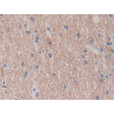 C-Ros Oncogene 1, Receptor Tyrosine Kinase (ROS1) Human Polyclonal Antibody
