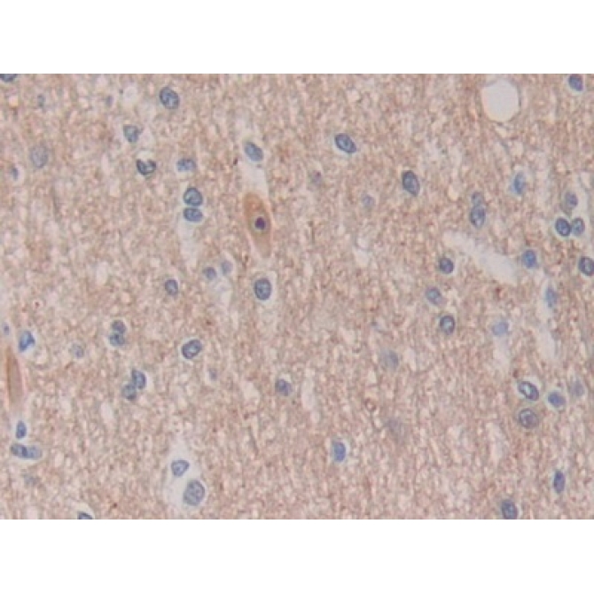 C-Ros Oncogene 1, Receptor Tyrosine Kinase (ROS1) Human Polyclonal Antibody