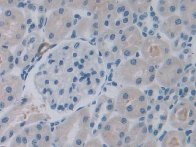 C-Ros Oncogene 1, Receptor Tyrosine Kinase (ROS1) Rat Polyclonal Antibody